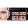TEOSYAL REDENSITY 2 PURESENSE