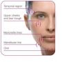 TEOSYAL ULTIMATE ZONES D'INJECTION