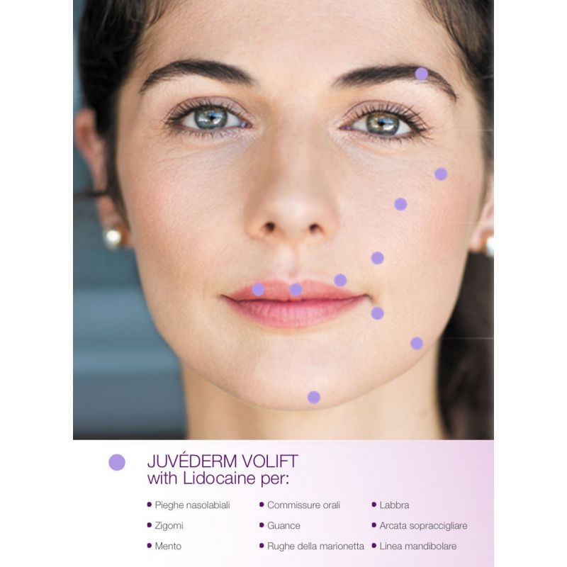 BUY JUVEDERM VOLIFT Volume for lips, cheeks, cheekbones, temples