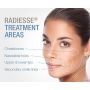 RADIESSE-BEHANDLUNGSBEREICHE