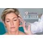 JUVEDERM VOLITE (2x1ml) ALLERGAN
