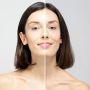 PLURYAL MESOLINE TIGHT (5x5ml) MD SKIN SOLUTIONS