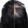 PLURYAL MESOLINE HAIR (5x5ml) MD SKIN SOLUTIONS