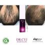 DR. CYJ HAIR FILLER (2x1ml) CAREGEN