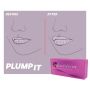 JUVEDERM ULTRA SMILE (2x0.55ml) ALLERGAN