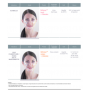 DEFINISSE RESTORE FILLER LIDO (1x1ml)