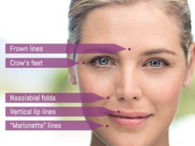 LES RIDES DU VISAGE | Comment les identifier, les comprendre et les prévenir?